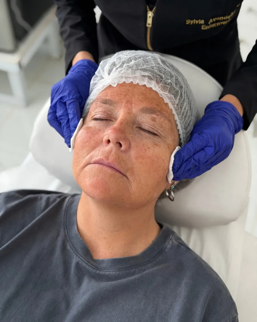 Limpieza facial profunda en Concón: retirada de impurezas con tórulas en la sala de procedimientos de Aphrodite